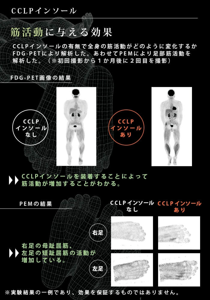 BMZ カルパワースポーツ CARBON3 黒《正規品》