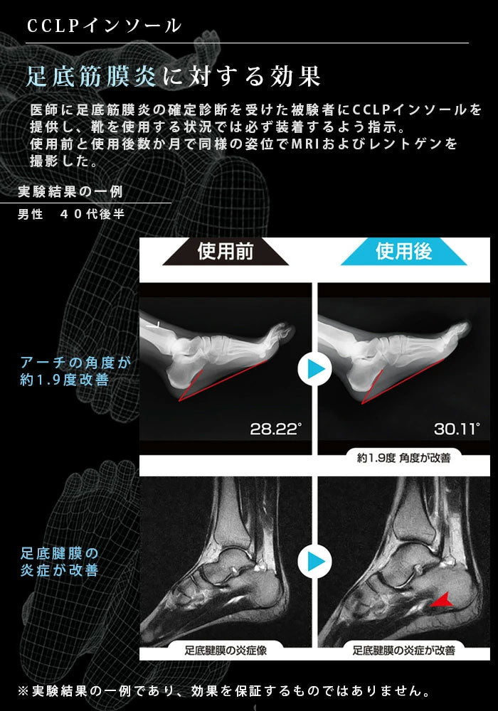 BMZ カルパワースポーツ CARBON3 黒《正規品》