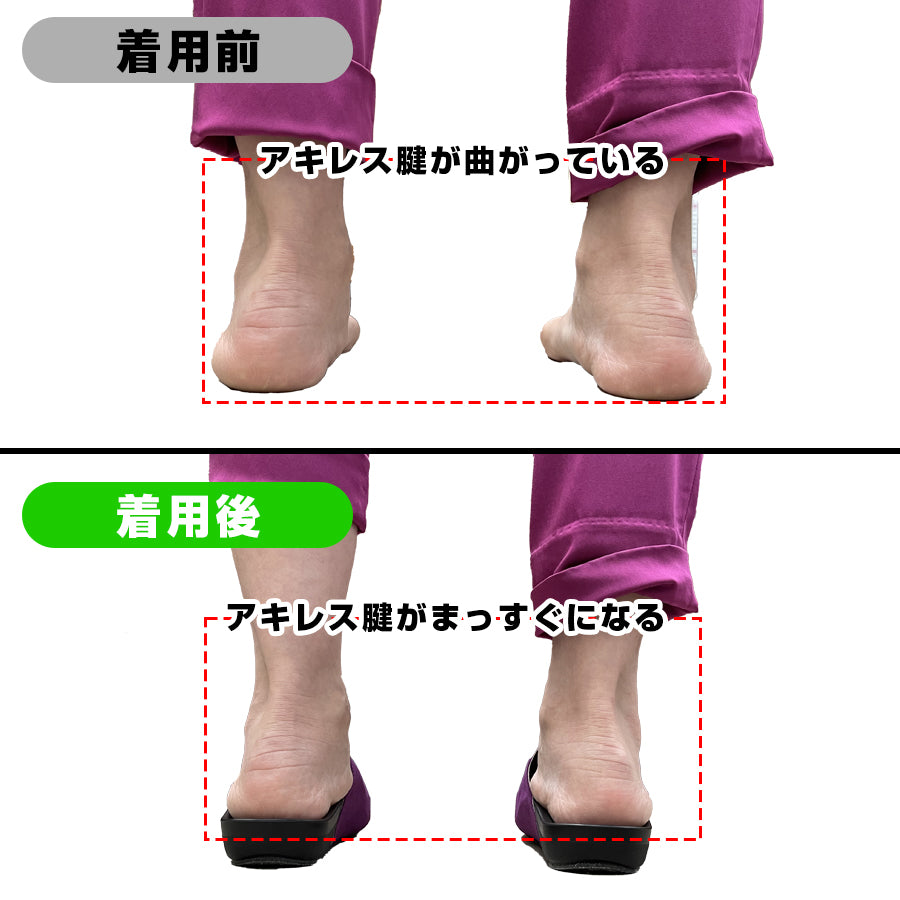 アーチフィッター601