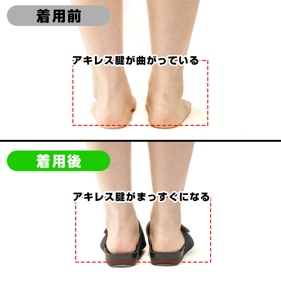 アーチフィッター601