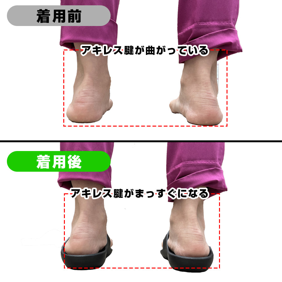 距骨サンダル / バンドタイプ
